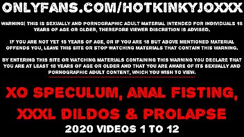 Hotkinkyjo XO speculum prolapse deep dildo belly bulge anal fisting & extreme insertions - onlyfans